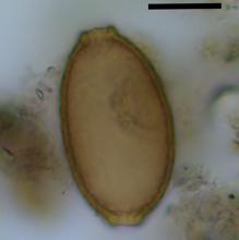 Huevo microscópico de tenia de pescado encontrado en coprolito de perro.  La barra de escala negra representa 20 micrómetros