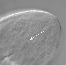 Imagen de microscopio del extremo posterior del ano de un ácaro